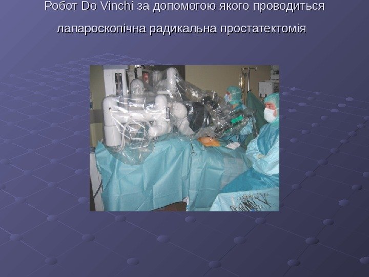   Робот Do Vinchi за допомогою якого проводиться лапароскопічна радикальна простатектомія  